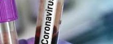 За сутки в Одесской области подтверждено +19 случаев COVID-19, среди них медики и пограничник. Всего в области 296 заболевших